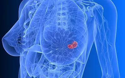 健康乳房图片,揭秘完美胸型的秘密